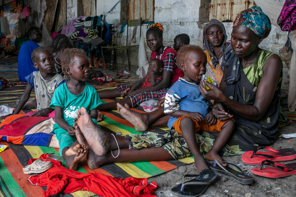 More than 450,000 children at risk of malnutrition in South Sudan (UNICEF)