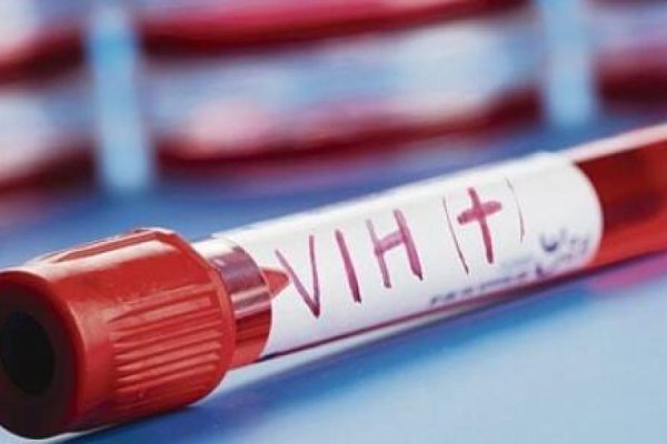 Cameroun : 21,000 new HIV cases per year