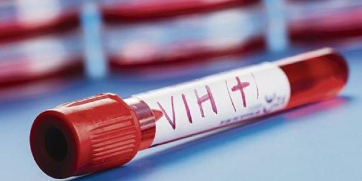 Cameroun : 21,000 new HIV cases per year