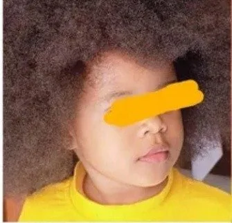 Cameroon: investigations opened after suspicion of rape of a two-year-old student in Odza
