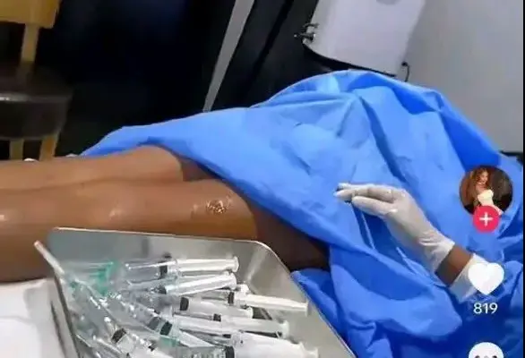 Cameroon: artificial enhancement of buttocks, breasts, the government raises awareness, the Medical Association attacks