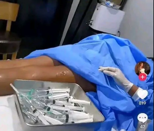 Cameroon: artificial enhancement of buttocks, breasts, the government raises awareness, the Medical Association attacks